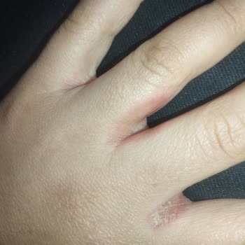 Narcissaaserola.net Narcissa Zayıflama Hapı