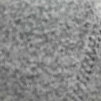 Aksigorta Tamamlayıcı Sağlık Sigortası Check Up Yetersiz