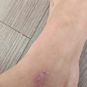 Elle Ayakkabı Sorunlu Yapılan Alışveriş