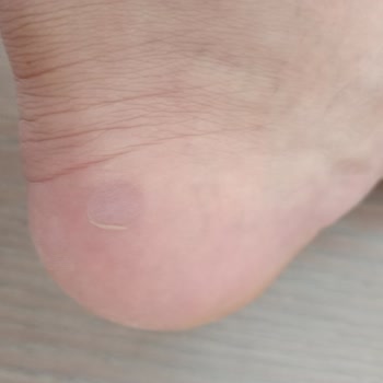 Elle Ayakkabı Sorunlu Yapılan Alışveriş