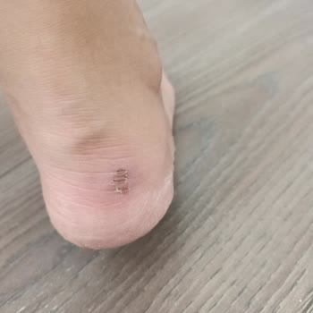 Elle Ayakkabı Sorunlu Yapılan Alışveriş