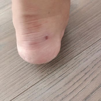 Elle Ayakkabı Sorunlu Yapılan Alışveriş