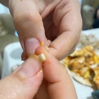 Usta Dönerci Yemek Siparişi Sorunu