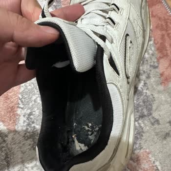 Skechers Türkiye Ayakkabı Sorunu