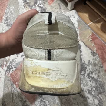 Skechers Türkiye Ayakkabı Sorunu