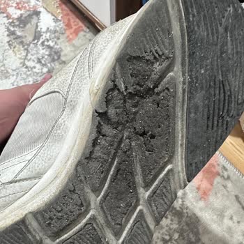 Skechers Türkiye Ayakkabı Sorunu
