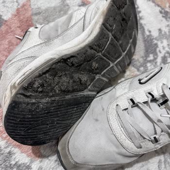 Skechers Türkiye Ayakkabı Sorunu