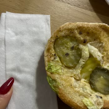 Burger King Hamburgerden Kıl Çıktı!