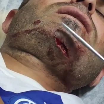 Türkiye Futbol Federasyonu Şanlıurfa Yıldırım Gücünün Katledilen Maçı