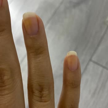 Pastel Kozmetik Pastel Marka Oje Tırnaklarımı 2 Günde Sararttı