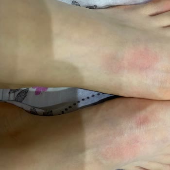 adidas Kalite Beklentisini Karşılamayan Ayakkabı Deneyimi