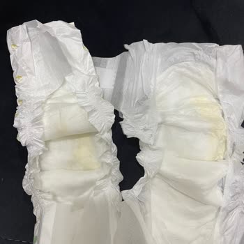 Baby Turco Bezdeki Sarı Lekeler