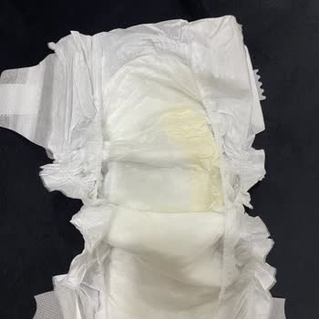 Baby Turco Bezdeki Sarı Lekeler