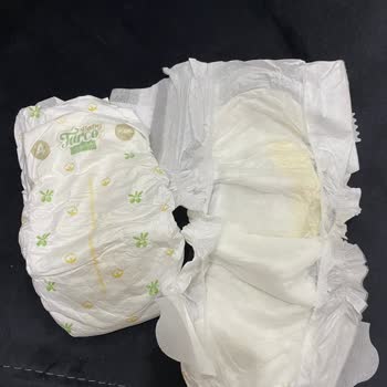 Baby Turco Bezdeki Sarı Lekeler