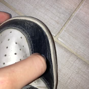 Sneaks Up Akasya Çöp Olan Ayakkabının Garanti Talebine Olumsuz Verdi