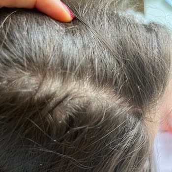 A101 1kg Lik Bioblas Şampuan