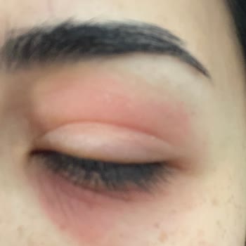 Isana Göz Kremi Şikayet