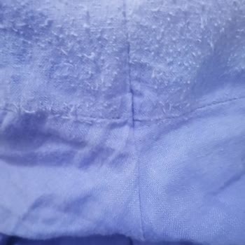 Oysho Kalitesizliği Ve Mağduriyeti