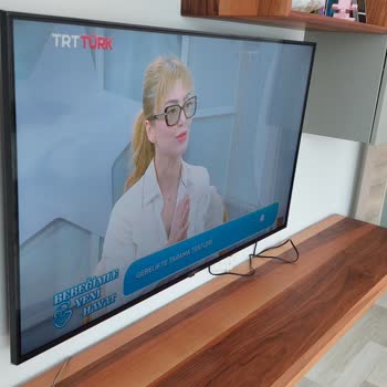 LG TV 50UR81006LJ Görüntüsü Çok Kötü