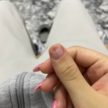 Bakırköy İpek Kirpik (By Selin Beauty) Manikür Sonrası Tırnak Sorunu
