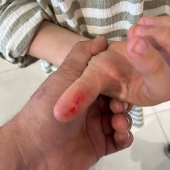 H&M Mağaza Camı Tehlikeli