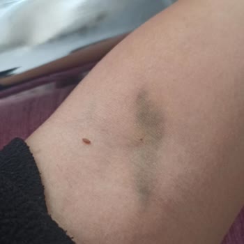 Afiyet Hastanesi Temizlik Ve Profesyonel Hizmet Beklemeyin, Fiyasko.