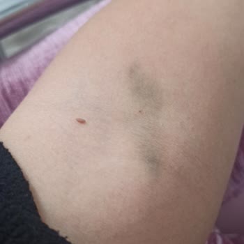 Afiyet Hastanesi Temizlik Ve Profesyonel Hizmet Beklemeyin, Fiyasko.