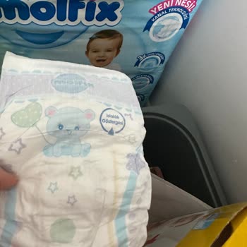 Molfix Bez Sızdırma Şikayeti