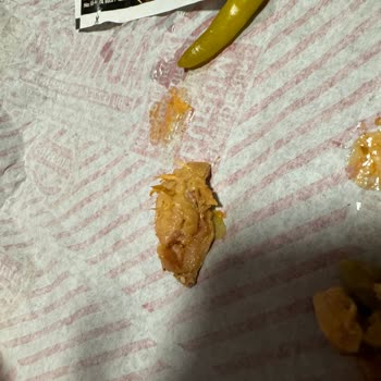 Amanos Döner Yediğimiz Tavuktan Hayvan Kılı Çıktı