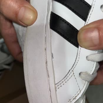 Adidas Marka Değerine Yakışır Şekilde Davranmadı