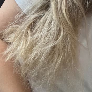 Ras Coiffure Yanmış Saç Takıldı