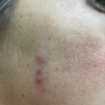 Bioderma Photoderm M Alerji