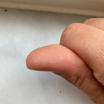 Bioderma Photoderm M Alerji