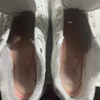 Skechers D'lites/Cepa/SuperStep/Ayakkabı Kalitesizliği/diyabetik Ayak