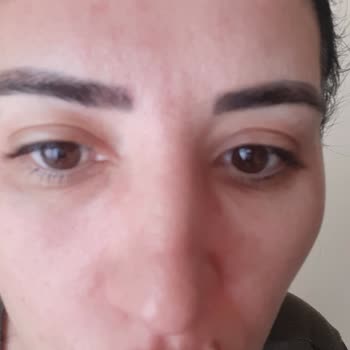 Rossmann Isına İntensiv Serum Vitamin C Yüzümü Mahvetti