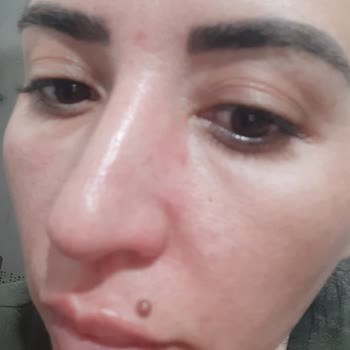 Rossmann Isına İntensiv Serum Vitamin C Yüzümü Mahvetti