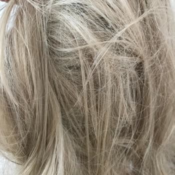 Sıla Saç Kaynak ve Peruk Merkezi Kadıköy Sıla Peruk Saç Kaynak