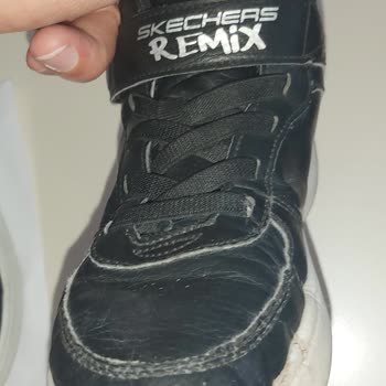 Skechers Ayakkabı Deformasyon Sorunu