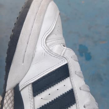 Adidas Deri Soyulması Ve Kalitesizliği