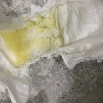 Molfix Bebek Bezinde Şaşırtan Kalite Sorunları!