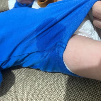 Molfix Bebek Bezinde Sızıntı