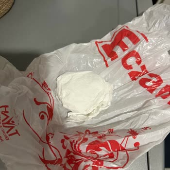 Hacettepe Üniversitesi Hastanesi Sağlık Ayıbı, Onkoloji Bölümünde Yaşanan Skandal