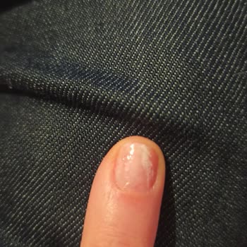 Watsons Takma Tırnak Çıkmadı.