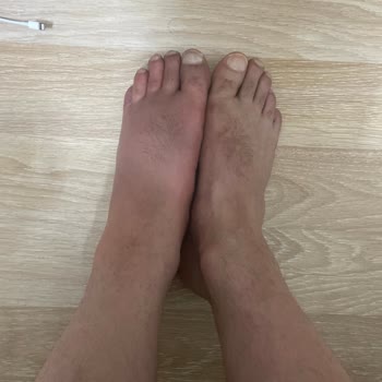 Deichmann Nemli Ve Sıkı Ayakkabı