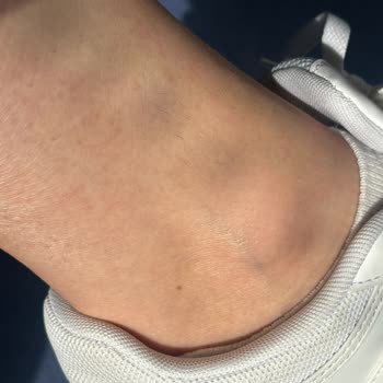 Novar Poliklinik Novar Karşıyaka Poliklinik Şikayet