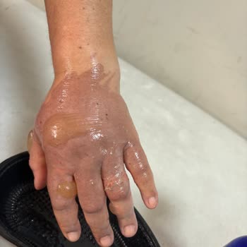 Özel Salihli Can Hastanesi Acil Serviste Yaşanan İhmalkarlık Ve Duyarsızlık