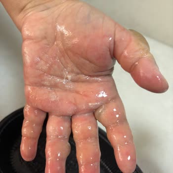 Özel Salihli Can Hastanesi Acil Serviste Yaşanan İhmalkarlık Ve Duyarsızlık