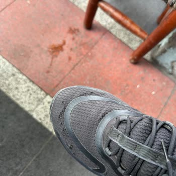 Adidas Ve Boyner Deforme Olmuş Ürünün İade Veya Değişimini Yapmıyor