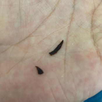 Koska Nazar Boncuklu Lokum İçerisinden Plastik Parça Çıktı