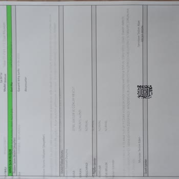 Monster Tulpar T7 19.5 Batarya Şişmesi